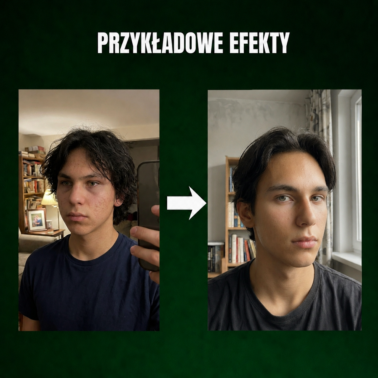 Glow Up w 30 Dni – Praktyczny przewodnik poprawy wyglądu