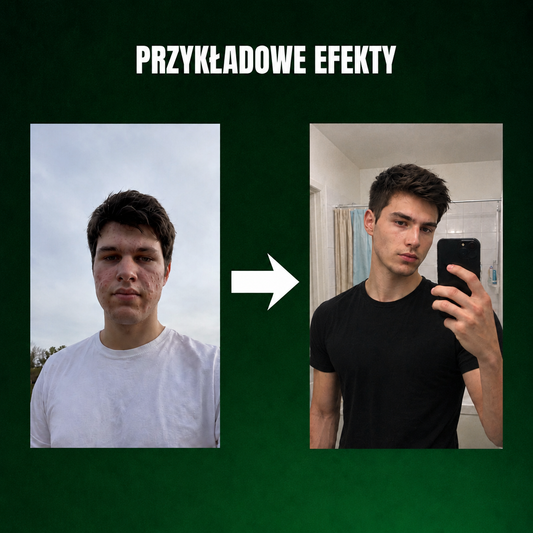 Glow Up w 30 Dni – Praktyczny przewodnik poprawy wyglądu